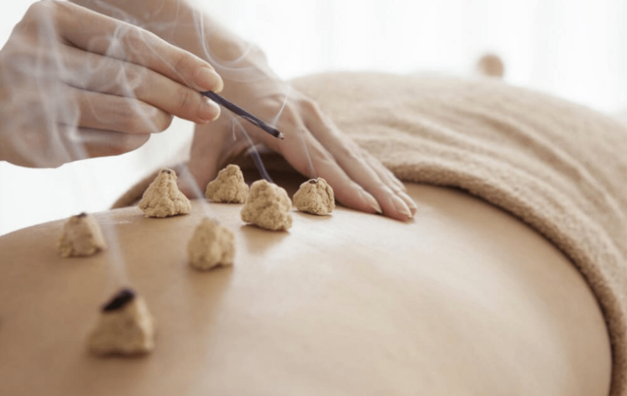 Moxibustion