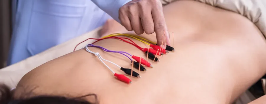Electroacupuncture